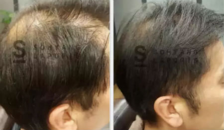 唯拾壹跨境美妝|我缺的不是卷發(fā)棒！不是錢(qián)！是頭發(fā)啊