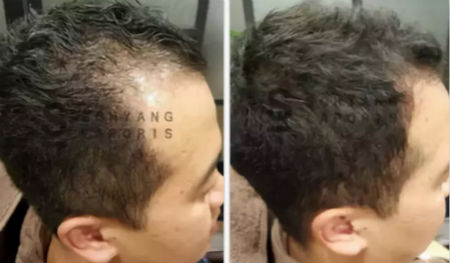 唯拾壹跨境美妝|我缺的不是卷發(fā)棒！不是錢(qián)！是頭發(fā)啊