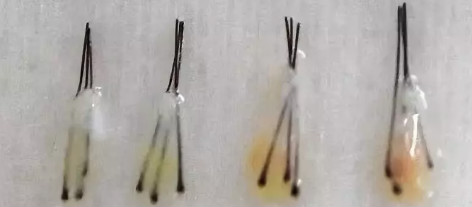 iGLORY完美睫毛增長(zhǎng)液，喚醒睫毛逆生長(zhǎng)，30天睫毛長(zhǎng)一倍