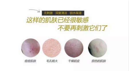 NewNewDIY|敏感肌如何選洗面奶？皮膚科醫(yī)生推薦這款！