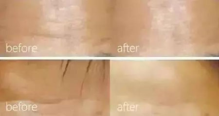 還在靠敷面膜補(bǔ)水？那你的皮膚肯定出問(wèn)題！