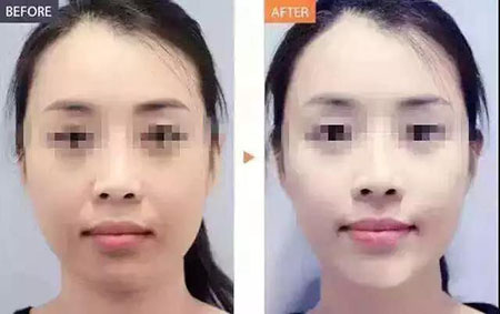 還在靠敷面膜補(bǔ)水？那你的皮膚肯定出問(wèn)題！