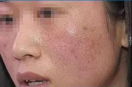 還在靠敷面膜補(bǔ)水？那你的皮膚肯定出問(wèn)題！