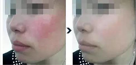 還在靠敷面膜補(bǔ)水？那你的皮膚肯定出問(wèn)題！