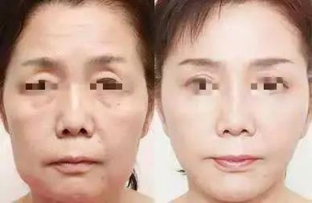 她只是做了個(gè)黃金V雕，3年后結(jié)果震驚了所有人！