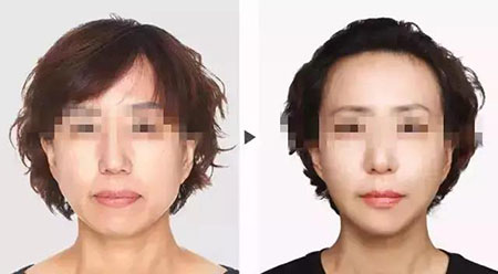 她只是做了個(gè)黃金V雕，3年后結(jié)果震驚了所有人！