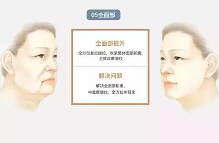 她只是做了個(gè)黃金V雕，3年后結(jié)果震驚了所有人！