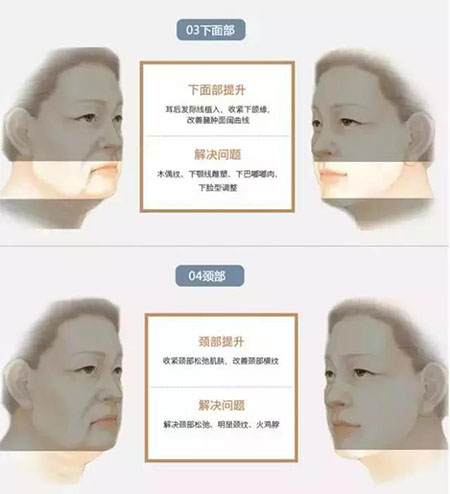 她只是做了個(gè)黃金V雕，3年后結(jié)果震驚了所有人！