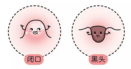 “閉口”這個磨人的小妖精又出來作妖啦！