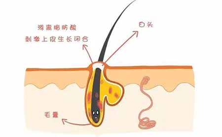 “閉口”這個磨人的小妖精又出來作妖啦！