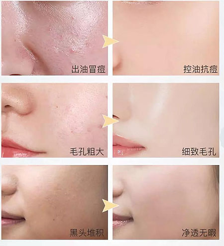 韓詩緹教你正確洗臉，現(xiàn)在！立刻！馬上！改善皮膚問題