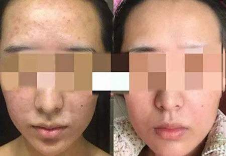 粉絲真實測評！DIY私人定制護膚品真有那么神奇嗎？