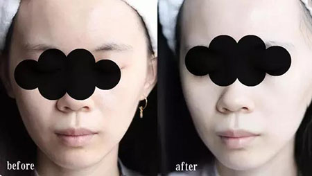 女人總愛(ài)摸這里，難怪會(huì)毀容，99%的人都中招！