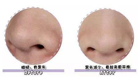 女人總愛(ài)摸這里，難怪會(huì)毀容，99%的人都中招！