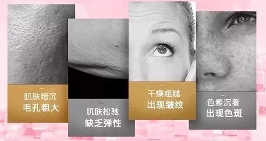 皮膚粗大還有救嗎？VN智能光電美膚讓你的肌膚不在“孔”慌