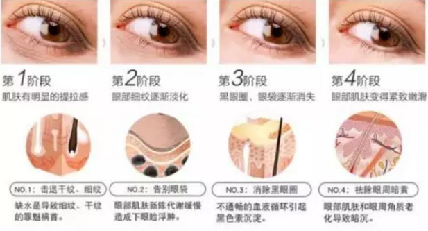講真，少女感的秘密全藏在這款韓詩緹凈雪眼霜里...