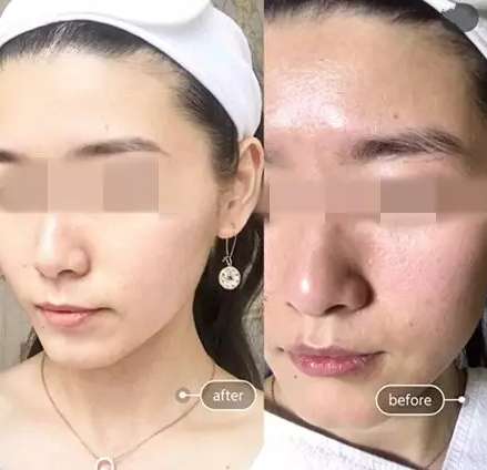 “一洗白”能變白？假的！它才是美白正確的打開(kāi)方式