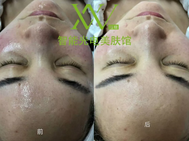 “一洗白”能變白？假的！它才是美白正確的打開(kāi)方式