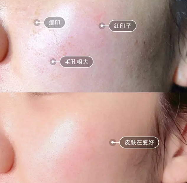 “一洗白”能變白？假的！它才是美白正確的打開(kāi)方式