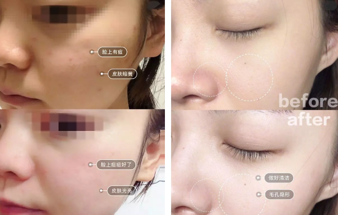 “一洗白”能變白？假的！它才是美白正確的打開(kāi)方式