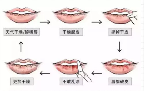 誰說夏天不用護唇膏?沒有它，再貴的口紅都沒用!