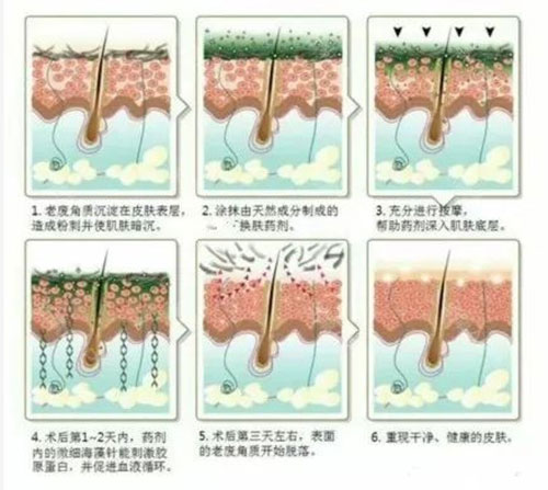 提亮膚色，收毛孔改善皺紋