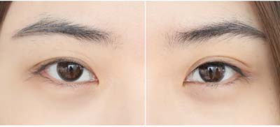 左右眼對(duì)比