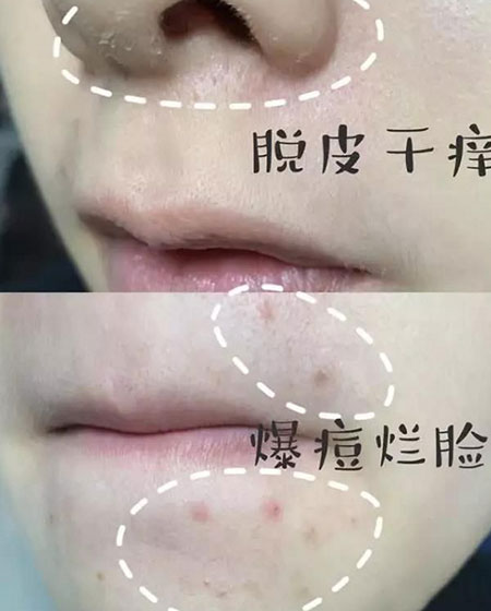 缺水是肌膚的萬(wàn)惡之源你有這樣的皮膚情況嗎