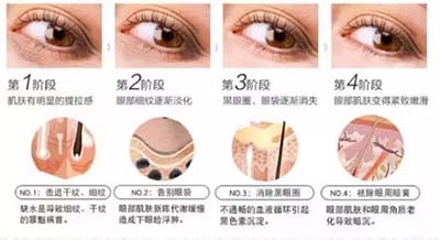 韓詩(shī)緹凈雪眼霜