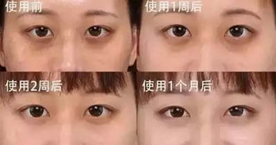 韓詩(shī)緹凈雪眼霜