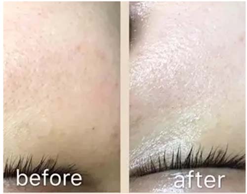 水光嫩膚管理深度補(bǔ)水、鎖水保濕