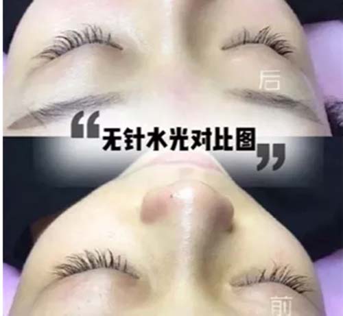 水光嫩膚管理凈化膚色、美白嫩膚