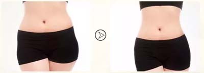 “操作30分鐘，腰圍減少3-6公分”這種健康美容瘦身的方法你知道嗎