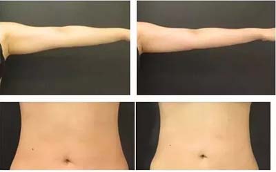 操作30分鐘，腰圍減少3-6公分”這種健康美容瘦身的方法你知道嗎