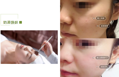 去暗黃、除色斑，VN美白管理讓你年輕十歲！