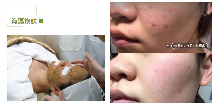 去暗黃、除色斑，VN美白管理讓你年輕十歲！