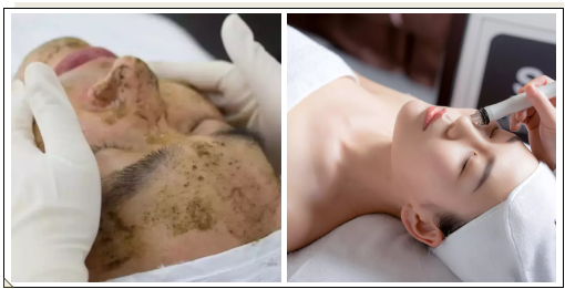 VN美膚經(jīng)：定期做皮膚管理的好處，值得每個人收藏！