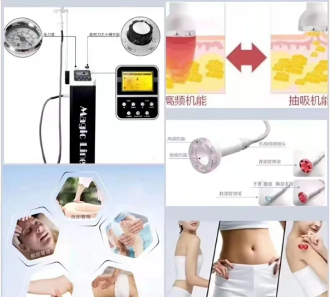 VN身體管理：告別虛胖！不用節(jié)食！燃脂塑形躺著就瘦