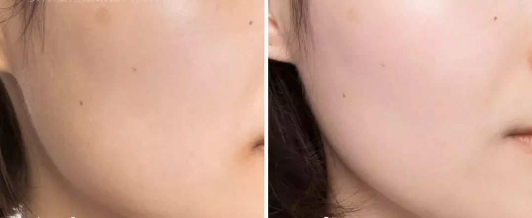 臉黃油皮怎么辦？推薦超好用的去黃神器！