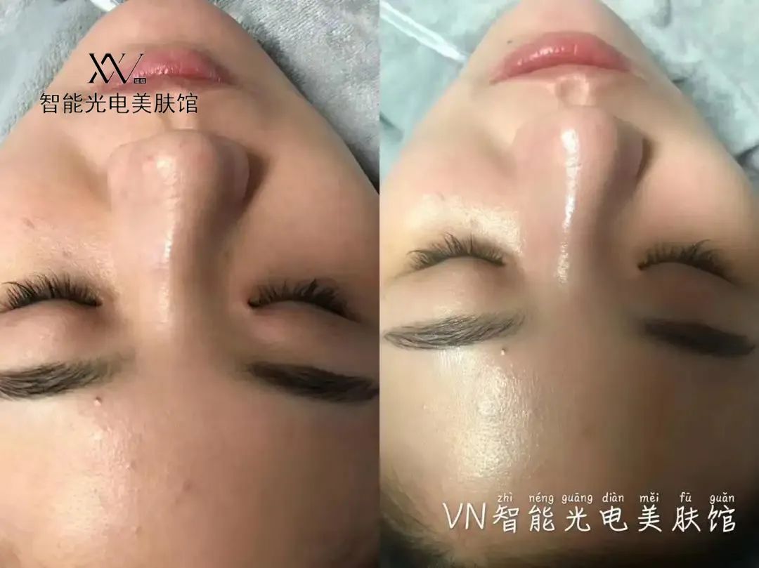 VN美業(yè)運營：掌握這5種需求，顧客追著你買單！