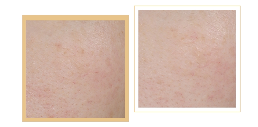 燕麥多糖抗皺乳液 | 抵御衰老侵襲，向時光開戰(zhàn)