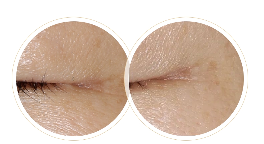 一篇秒懂！為何定期做皮膚管理的人不易老？