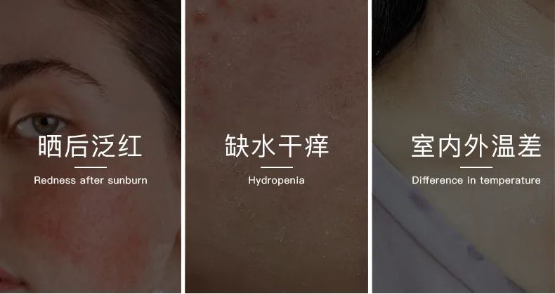 無懼時光，天生優(yōu)雅，敏感肌&受損肌的修護“膜”法